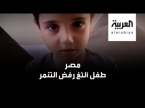 شاهد طفل مصري ألدغ يرد على المتنمرين بخفة دم